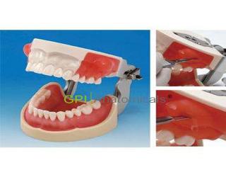 GPI/D85SFE-X.1051國家醫師考試專用牙槽膿腫切開與牙體預備模型
