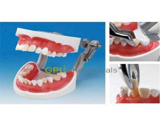 GPI/D16D-X.1050國家醫師考試專用拔牙模型
