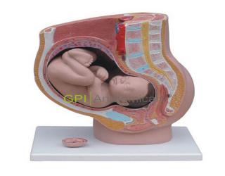 GPI/A15101/1女性盆腔矢狀解剖模型(4件)
