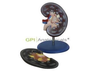 GPI/A14005/1腎解剖模型2件