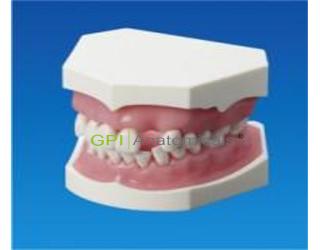 GPI/P15-SMC.3牙周松動牙固定實習模型