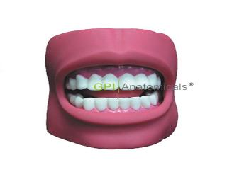 GPI/K4牙護理保健模型（帶臉頰，自然大）